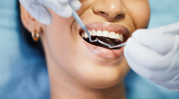 Best Root Canal Emergency Dentist  in Gwinn, MI