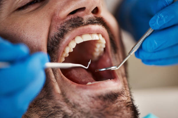Best Emergency Tooth Extraction  in Gwinn, MI